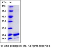 Sino Biological Recombinant Human IL-36 alpha/IL-1F6 Protein (aa 6-158),