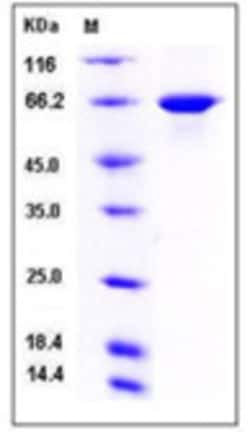 Sino Biological Recombinant Human Harmonin/USH1C Protein (His Tag), Quantity: