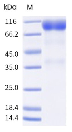 Sino Biological&nbsp;Recombinant Human FGFR1 Protein (beta (IIIc), hFc Tag), Biotinylated 20 µg