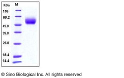 Sino Biological Recombinant Human FGFR1 Protein (His Tag), HPLC-verified,
