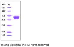 Sino Biological Protein Human CA12 50ug, Quantity: Each of 1
