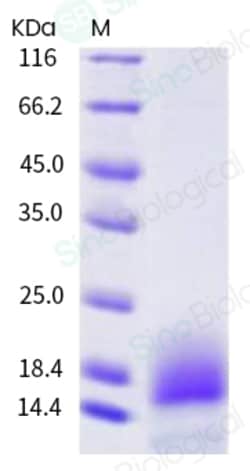 Sino Biological Recombinant Human BCMA Protein (ECD, His Tag), HPLC-verified,