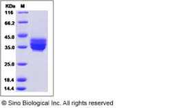 Sino Biological Human TNFRSF17 / BCMA / CD269 Protein (rFc Tag) 100ug,