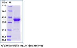 Sino Biological Recombinant Human BCMA Protein (mFc Tag), HPLC-verified,