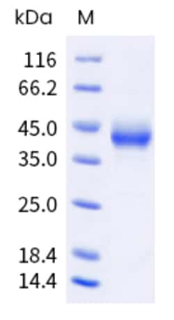 Sino Biological Human TNFRSF17 Protein 20ug (Sino Biological), Quantity: