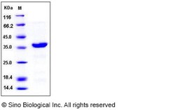 Sino Biological Recombinant Human EMAPII/AIMP1 Protein (His Tag), Quantity: