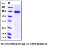 Sino Biological Recombinant Human CK2 alpha/CSNK2A1 Protein (GST Tag),