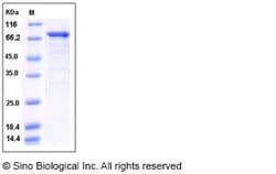 Sino Biological Human CDK16 / PCTAIRE1 / PCTK1 Protein (GST Tag) 50ug,
