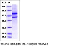 Sino Biological Recombinant Human SPOCK1 Protein (His Tag), Quantity: Each
