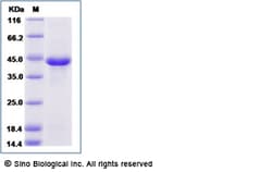 Sino Biological Human Inhibin beta E / INHBE Protein (Fc Tag) 100ug, Quantity: