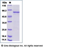 Sino Biological Human Raf-1 / RAF1 Protein (His & GST Tag) 50ug, Quantity: