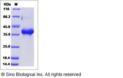 Sino Biological Recombinant Human Neuregulin-1/NRG1 Protein (hFc Tag),