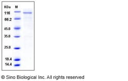 Sino Biological Human CAMK4 / CaMKIV Protein (GST Tag) 50ug, Quantity: