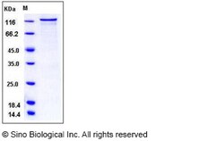Sino Biological Recombinant Human PKC nu Protein (GST Tag), Quantity: Each
