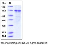 Sino Biological Recombinant Human PLK1 Protein (His Tag), HPLC-verified,