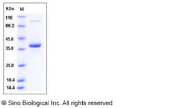 Sino Biological Recombinant Human Epiregulin Protein (hFc Tag), Quantity: