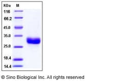 Sino Biological Recombinant Human ULBP1/NKG2DL1 Protein (His Tag) 1 mg,