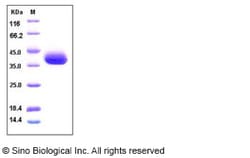 Sino Biological Recombinant Human SFRP1 Protein (His Tag), HPLC-verified,