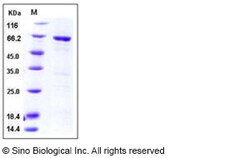Sino Biological Recombinant Human MAPKAPK3 Protein (GST Tag), Quantity: