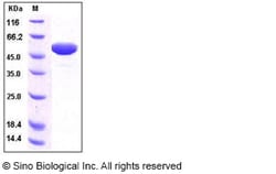 Sino Biological Recombinant Human Apolipoprotein A-I/APOA1 Protein (hFc