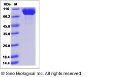 Sino Biological Recombinant Human DPP-4/CD26/DPPIV Protein (His Tag), HPLC-verified,