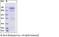 Sino Biological Protein Human DPP4 50ug, Quantity: Each of 1