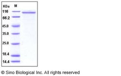 Sino Biological Recombinant Human Angiopoietin-2/ANGPT2 Protein (hFc Tag)