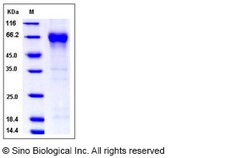 Sino Biological Recombinant Human Angiopoietin-2/ANGPT2 Protein (His Tag),