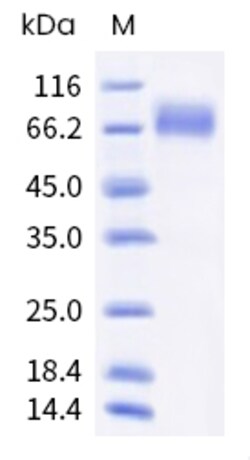 Sino Biological Recombinant Human Angiopoietin-2/ANGPT2 Protein (His Tag),