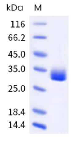 Sino Biological Human ANGPT2 Protein 100ug (Sino Biological), Quantity: