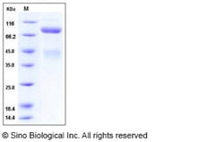Sino Biological Recombinant Human c-MET/HGFR Protein (ECD, His Tag), HPLC-verified,
