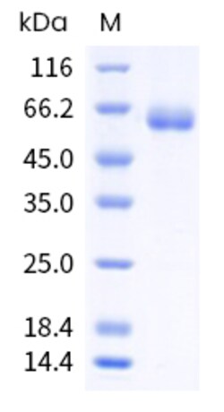 Sino Biological Human EpCAM Protein 1MG (Sino Biological), Quantity: Each