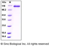 Sino Biological Recombinant Human Neuropilin-2/NRP2 Protein (His Tag),