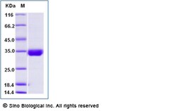 Sino Biological Human CD122 / IL-2RB Protein (His Tag) 100ug, Quantity: