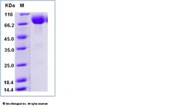 Sino Biological Protein Human CD80 100ug, Quantity: Each of 1
