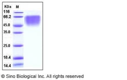 Sino Biological Recombinant Human B7-2/CD86 Protein (His Tag), Quantity: