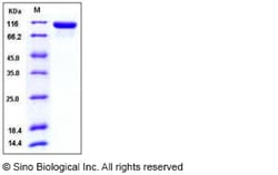 Sino Biological Human Tie2 / CD202b / TEK Protein (ECD, His Tag) 100ug,