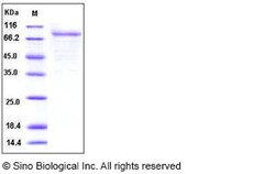 Sino Biological Human CSF2RA / GM-CSFR / CD116 Protein (Fc Tag) 100ug,