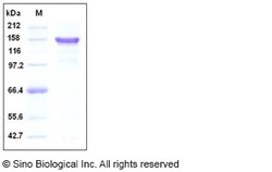 Sino Biological Recombinant Human Beta-amyloid/Beta-APP Protein (hFc Tag),