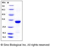 Sino Biological Beta-amyloid 40 / Beta-APP40 Protein, Human, Recombinant