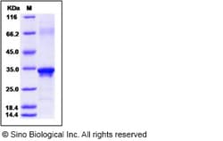Sino Biological Beta-amyloid 39 / Beta-APP39 Protein, Human, Recombinant