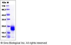 Sino Biological Human Interferon beta / IFN-beta / IFNB Protein 20ug, Quantity: