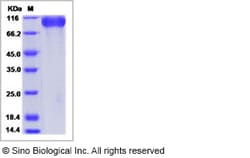 Sino Biological Recombinant Human Meprin beta Protein (ECD, His Tag), Quantity: