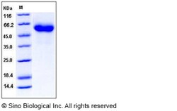 Sino Biological Recombinant Human Factor H Protein (His Tag), HPLC-verified,