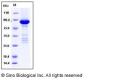 Sino Biological Recombinant Human TRIB2 Protein (His & GST Tag), Quantity:
