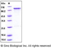 Sino Biological Human OXSR1 / OSR1 Protein (GST Tag) 50ug, Quantity: Each