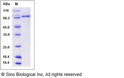 Sino Biological Recombinant Human DDR1 Protein (aa 444-913, His & GST Tag),