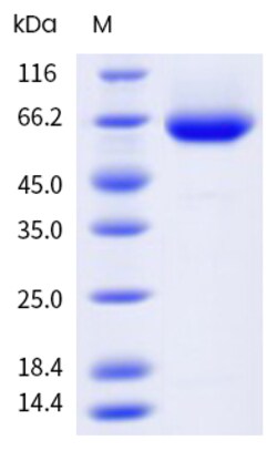 Sino Biological&nbsp;Recombinant Human DDR1 Protein (His & AVI Tag), HPLC-verified, Endotoxin-Free 20 µg