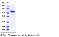 Sino Biological Human IRAK4 / IRAK-4 Protein (His Tag) 50ug, Quantity: