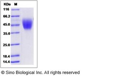 Sino Biological Recombinant Human B7-H4 Protein (ECD, His Tag), HPLC-verified,